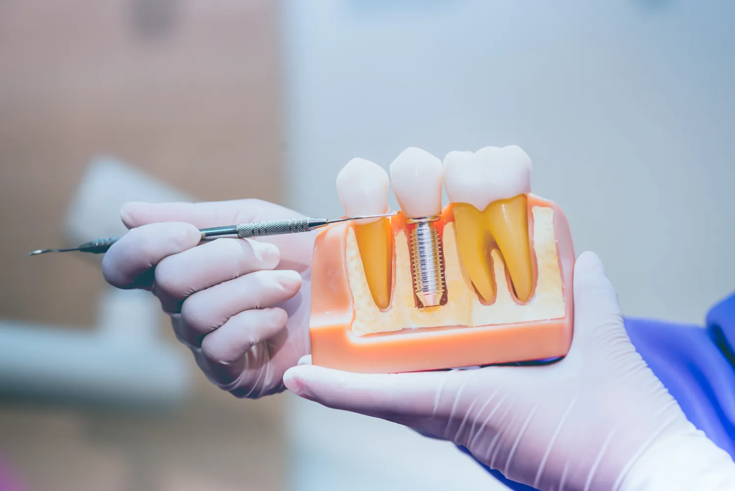 Endodoncja Szczecin