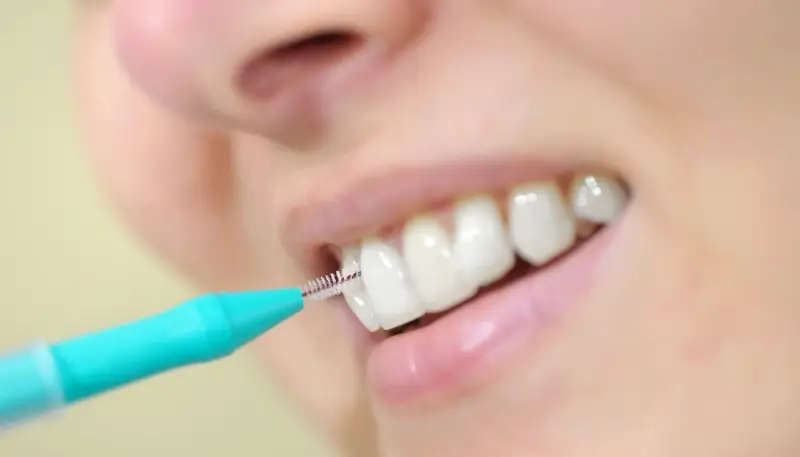 Najlepszy licówki Szczecin